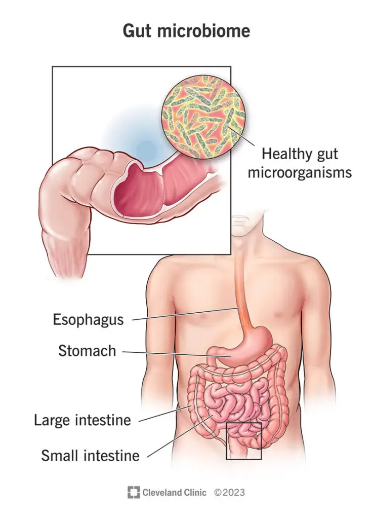 eliminate SIBO